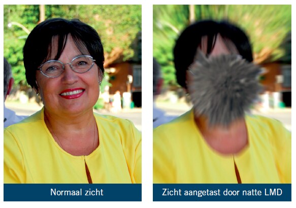 normal-sight-lmd